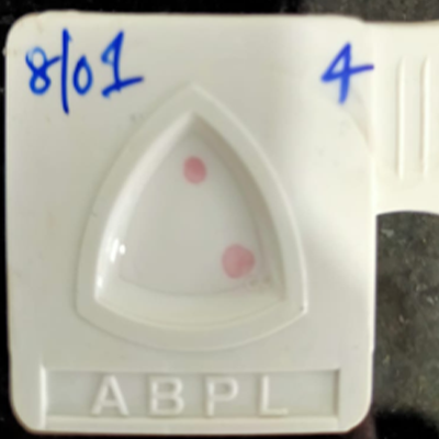 Rapid diagnostic device for detection of COVID-19 Antigen